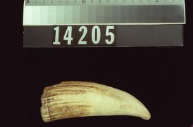 Image representing Tooth.